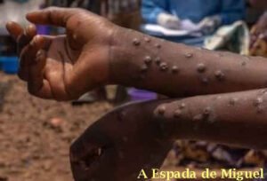 contaminacao-por-ebola